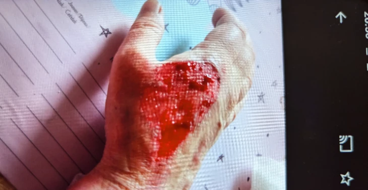 Hilfe für Medikamente und Verbandsmaterial