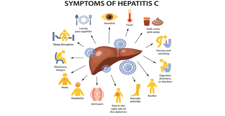 Help Svitlana niet te sterven aan Hepatitis C