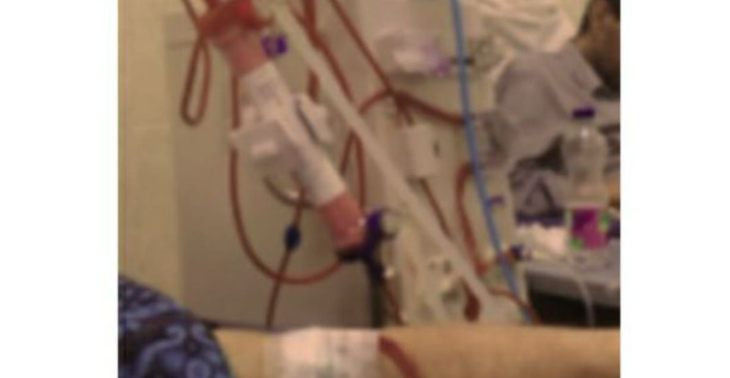 kidney failure