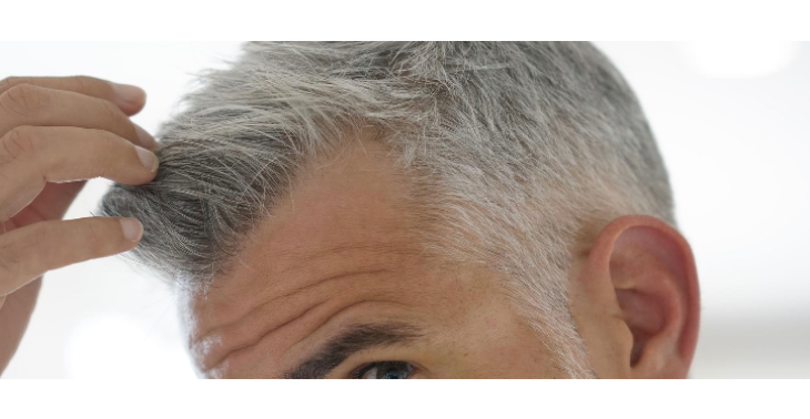 Geen haarverlies en grijze haren meer ✅ no more grey hair, no more hairloss