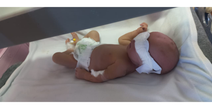Help Abdul Karim Heal: A War Child’s Fight for Life