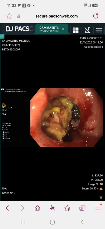 screenshot 20250617 093353 gallery.