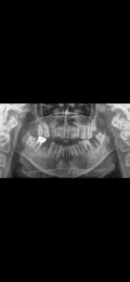 img 0374