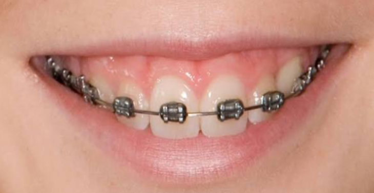 Schenk uns ein Lächeln