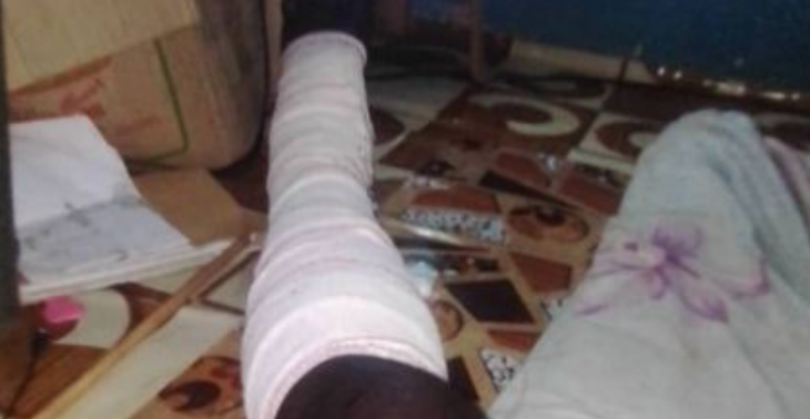 Afrikaanse jongen gewond; red zijn been van amputatie :-(
