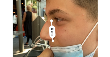 Neus operatie