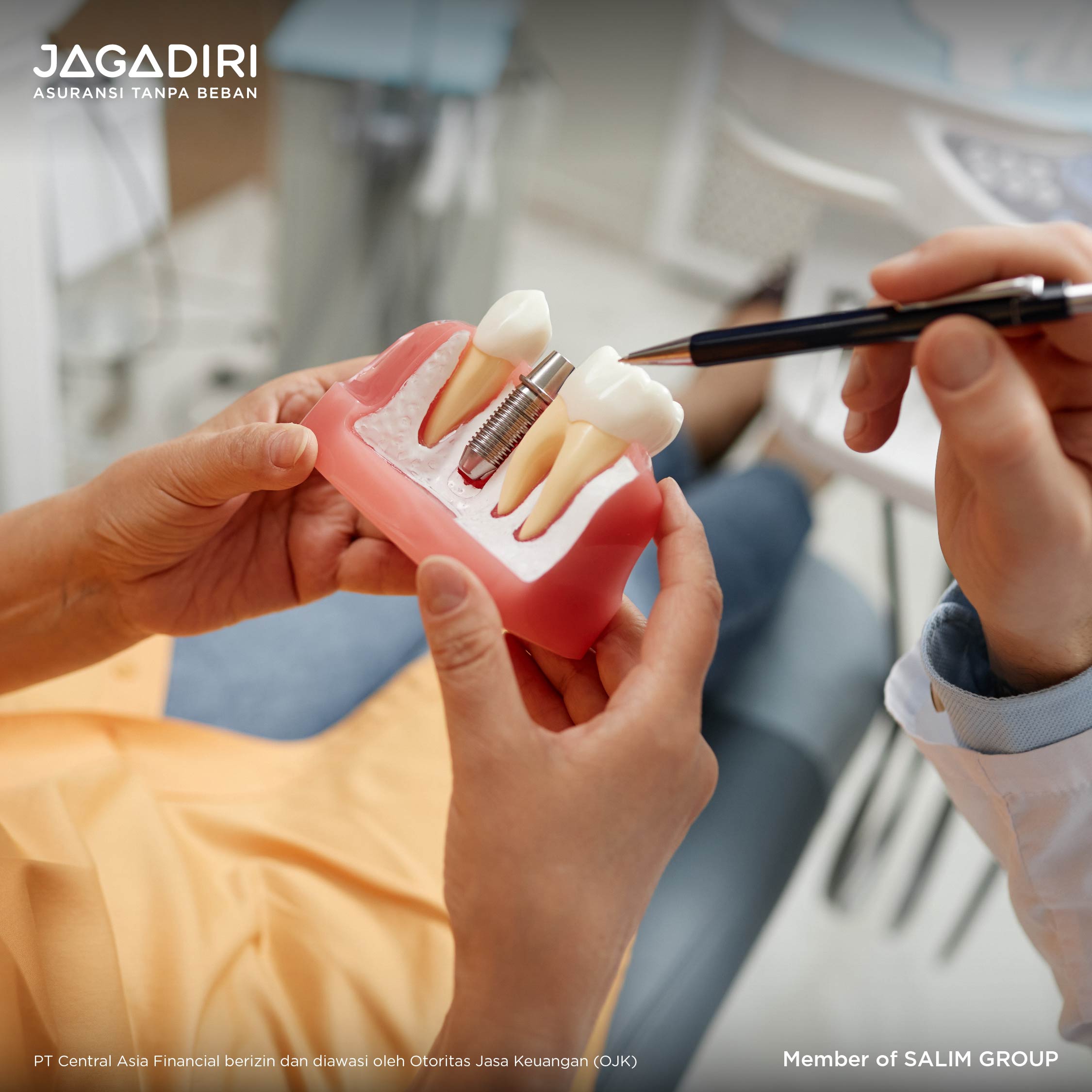 Yuk Cari Tau Biaya Implan Gigi Serta Prosedur dan Manfaatnya
