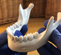 Loose Teeth 3D model
