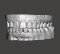 DENTAL MODEL 3D model