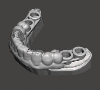 SURGICAL SPLINT FOR GUIDED SURGERY 3D model