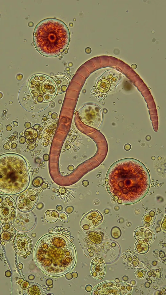 13 Micro 05 Protozoa