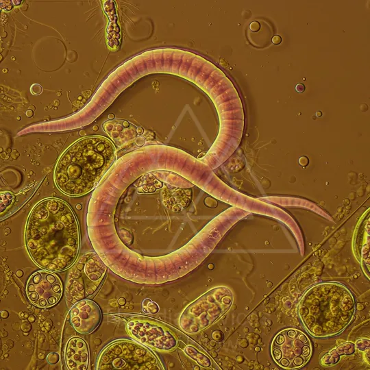14 Micro 05 Protozoa
