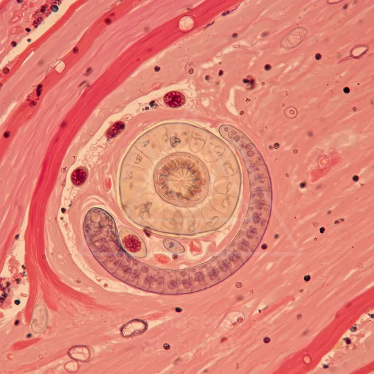 6 Micro 05 Worms 02 Parasitic Micro Worm