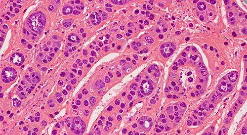 Histopathology of lung tissue — 8K royalty-free microscopic stock photo