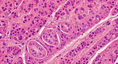 Prostate histopathology – microscopic view of glandular tissue — 8K royalty-free microscopic stock photo