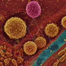 Colorized electron micrograph of round, textured cells among fibrous tissue with rod-shaped bacteria along a blue fiber — 8K royalty-free microscopic stock photo