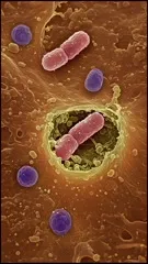 Color-enhanced micrograph of a blood vessel showing pink rod-shaped bacteria within the lumen, surrounded by purple spherical cells and cellular debris, a close-up view of microbial invasion — 4K royalty-free microscopic stock footage