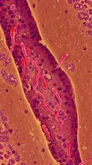 A high-magnification image of parasitic flatworm larvae within host tissue, showing elongated, pink worm-like bodies among cells and surrounding cellular structures, likely captured by electron or confocal microscopy — 4K royalty-free microscopic stock footage