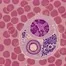 A highly magnified microscopic cross-section reveals a parasite inside a host cell, showcasing intracellular organelles, vesicles, and complex cellular architecture in vivid purple and pink hues — royalty-free microscopic stock footage