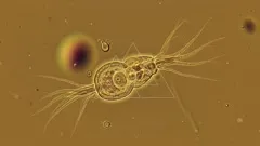A microscopic organism displays a segmented body with numerous hair-like appendages, seemingly preparing to extend its filaments. The golden backdrop highlights intricate internal structures, suggesting a parasitic micro-scale life form — 4K royalty-free microscopic stock footage