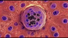 Color-enhanced microscopic image of a cancer cell cluster, highlighting a central group of dark, irregular nuclei surrounded by purple-stained cells, illustrating malignant growth within tissue — 4K royalty-free microscopic stock footage