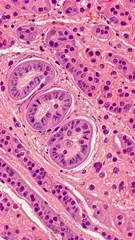 Histopathology image of prostate gland acini with glandular epithelium and surrounding stroma, showing typical pink hematoxylin-eosin stained glandular architecture — 4K royalty-free microscopic stock footage