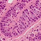 Micrograph of kidney histopathology highlighting tubular structures with cuboidal epithelium, prominent nuclei, and eosinophilic cytoplasm, set in a pink-stained interstitium, illustrating typical renal tubule morphology — 2K royalty-free microscopic stock footage