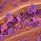 Close-up view of a fungal infection at the micro scale, illustrating purple fungal cells and spores intertwined with host tissue, highlighting microbial interactions and the contagious nature of fungal pathogens — 2K royalty-free microscopic stock footage