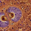 Micrograph illustrating infectious toxoplasma cysts within host tissue, highlighting purple-stained parasitic structures embedded in a surrounding cellular matrix, revealing intracellular forms and surrounding inflammatory responses — 2K royalty-free microscopic stock footage