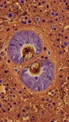 Micrograph showing infectious toxoplasma in tissue, highlighting intracellular parasites within host cells and surrounding inflammatory tissue, rendered in vivid colors to emphasize cellular structures and nuclei — 4K royalty-free microscopic stock footage