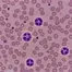 Microscopic blood smear showing multiple neutrophils with segmented nuclei among numerous pink erythrocytes, highlighting cellular morphology under high magnification — royalty-free microscopic stock footage