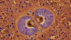 A high-magnification histology image showing purple-stained glandular cells around central ducts, embedded in orange connective tissue with scattered nuclei and a rich extracellular matrix texture — 4K royalty-free microscopic stock footage