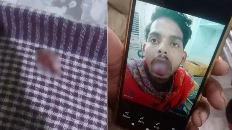 Uttar Pradesh Wife cuts husband tongue with a knife in Ghaziabad