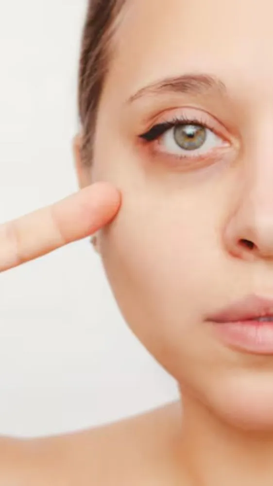 अब नहीं रहेंगे आंखों के नीचे काले घेरे! जानिए डार्क सर्कल्स हटाने के लिए क्या लगाएं