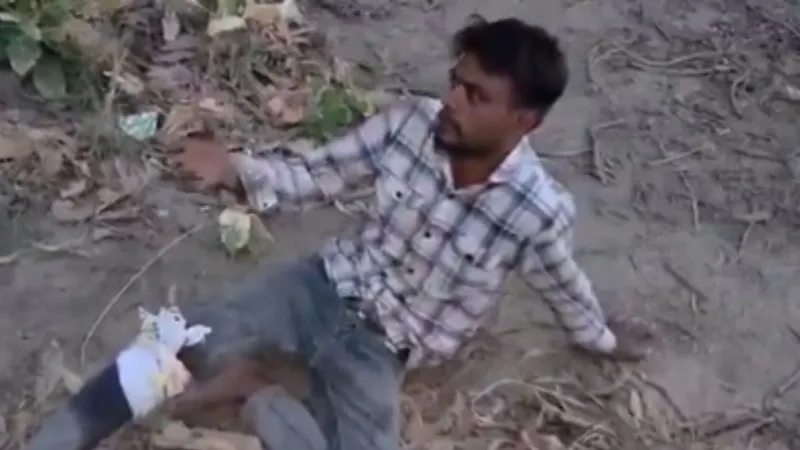 साहब एक सिगरेट पिला दो... मुजफ्फरनगर में एनकाउंटर के बाद पुलिस से फरमाइश करने लगा बदमाश, देखें VIDEO