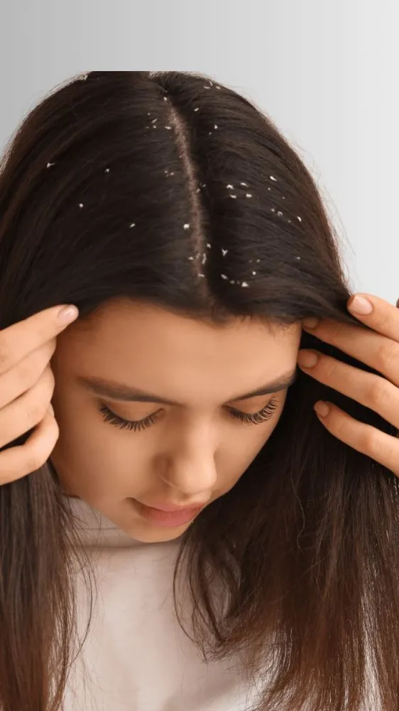 शैंपू से सच में झड़ते हैं बाल या ये सिर्फ एक मिथक? जानिए हेयर फॉल की असली वजह