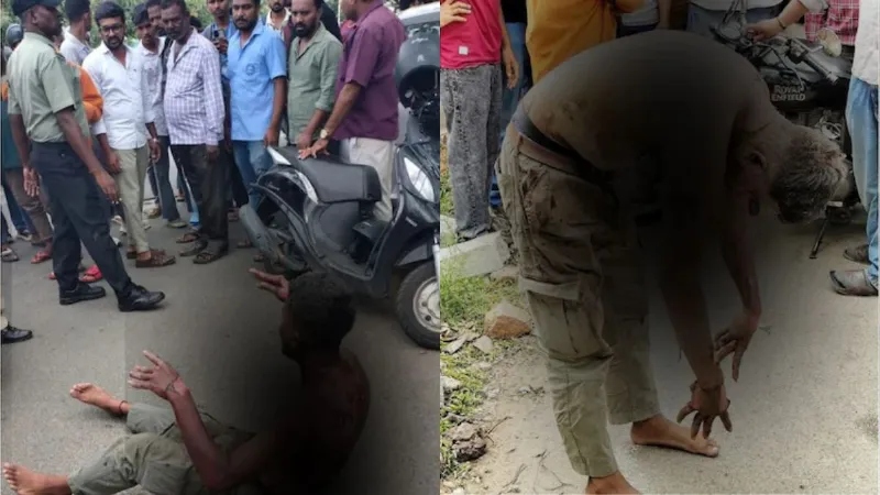 सनकी आशिक की खौफनाक करतूत! प्रपोजल ठुकराने पर कॉलेज के बाहर खुद को लगाई आग, फिर जो हुआ...