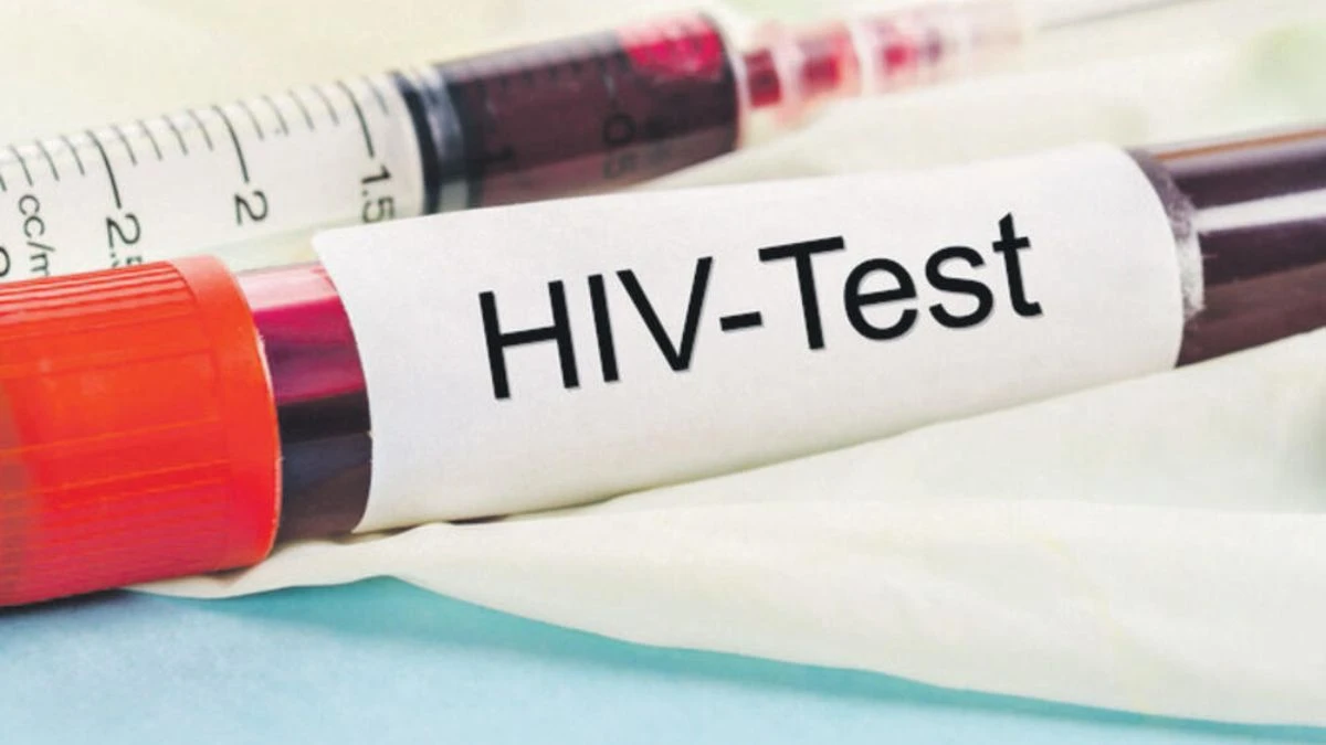 HIV Infection: त्रिपुरा राज्य में 800 से अधिक छात्र एचआईवी पॉजिटिव , जानें क्या हैं लक्षण?