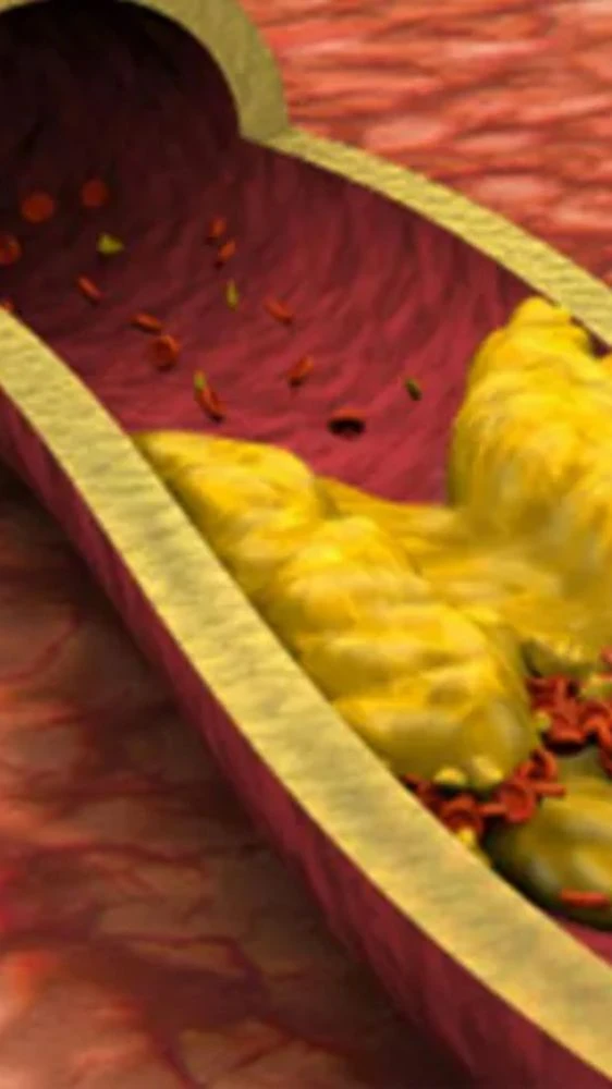 Health Benefits: कच्चे केले खाने से शरीर को मिलेंगे दमदार फायदे, जानें कैसे