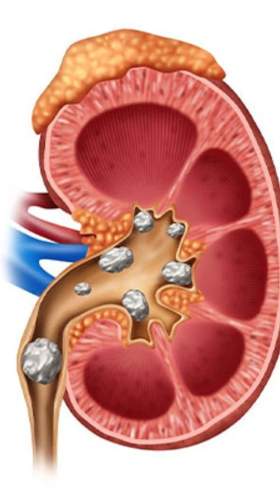 कैंसर जैसी बीमारी होगी दूर, इस फल का करें सेवन