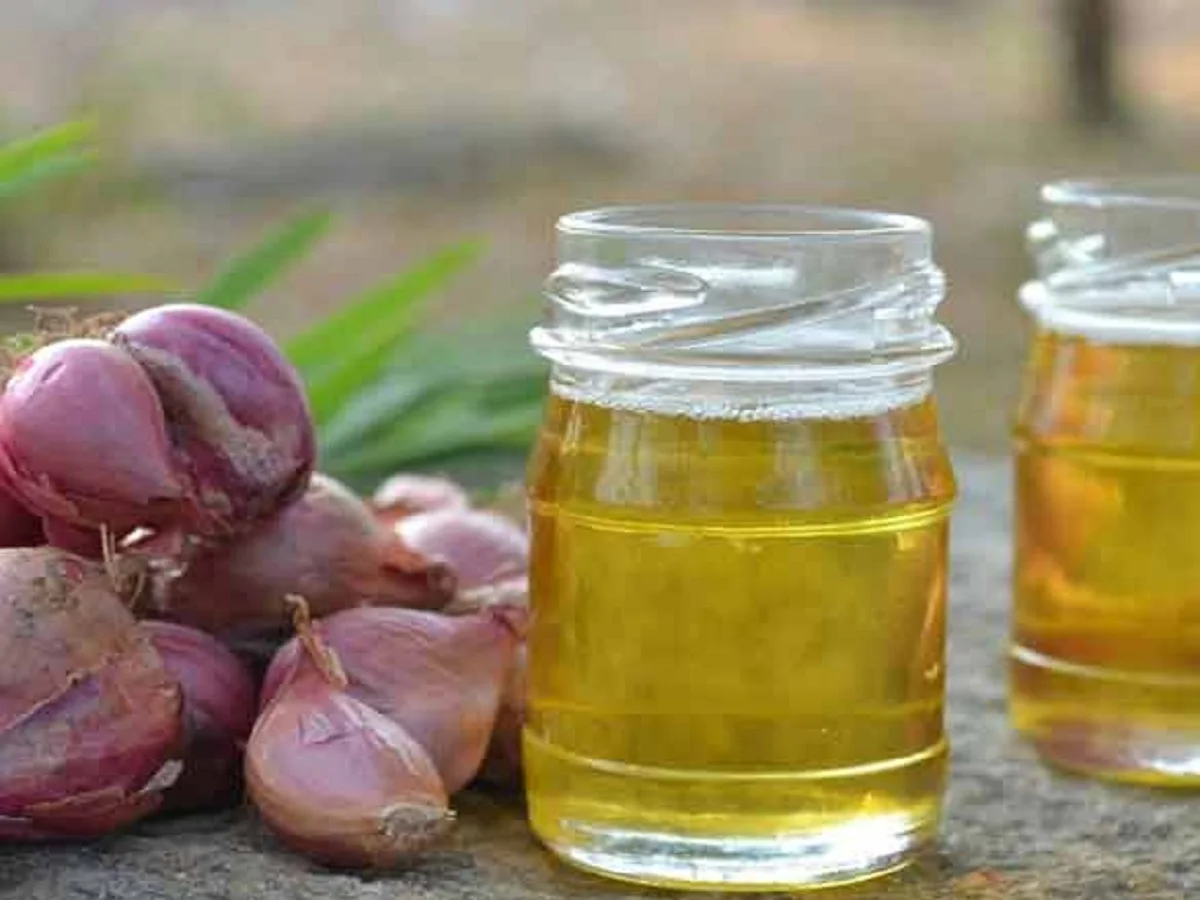 Hair Care Tips: इस प्रकार बना लें प्याज का तेल, बालों के लिए होता है बहुत ही लाभकारी