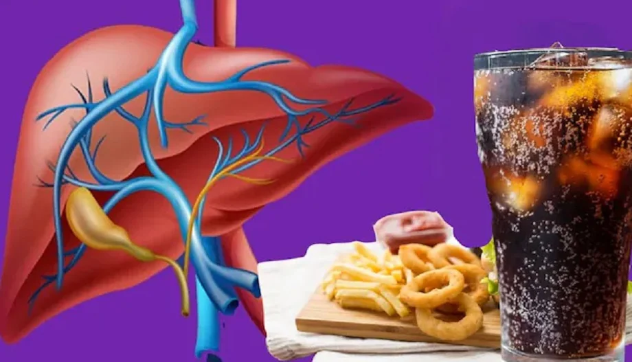 Health Tips:  शराब ही नहीं, ये पांच चीजें भी लिवर को करती हैं खराब, आज से ही बना लें दूरी