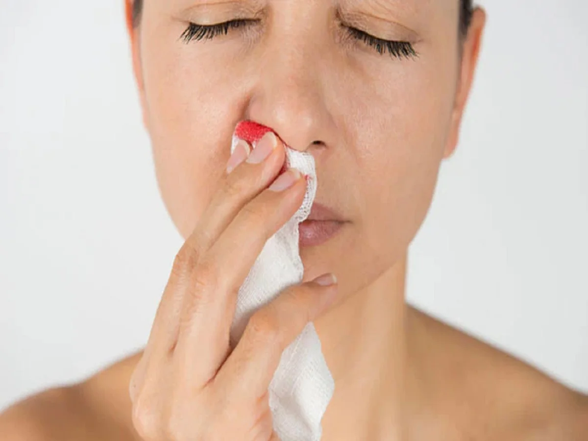 Health Tips: नाक से बहता हैं बार बार खून तो हो सकते है इस बीमारी के लक्षण