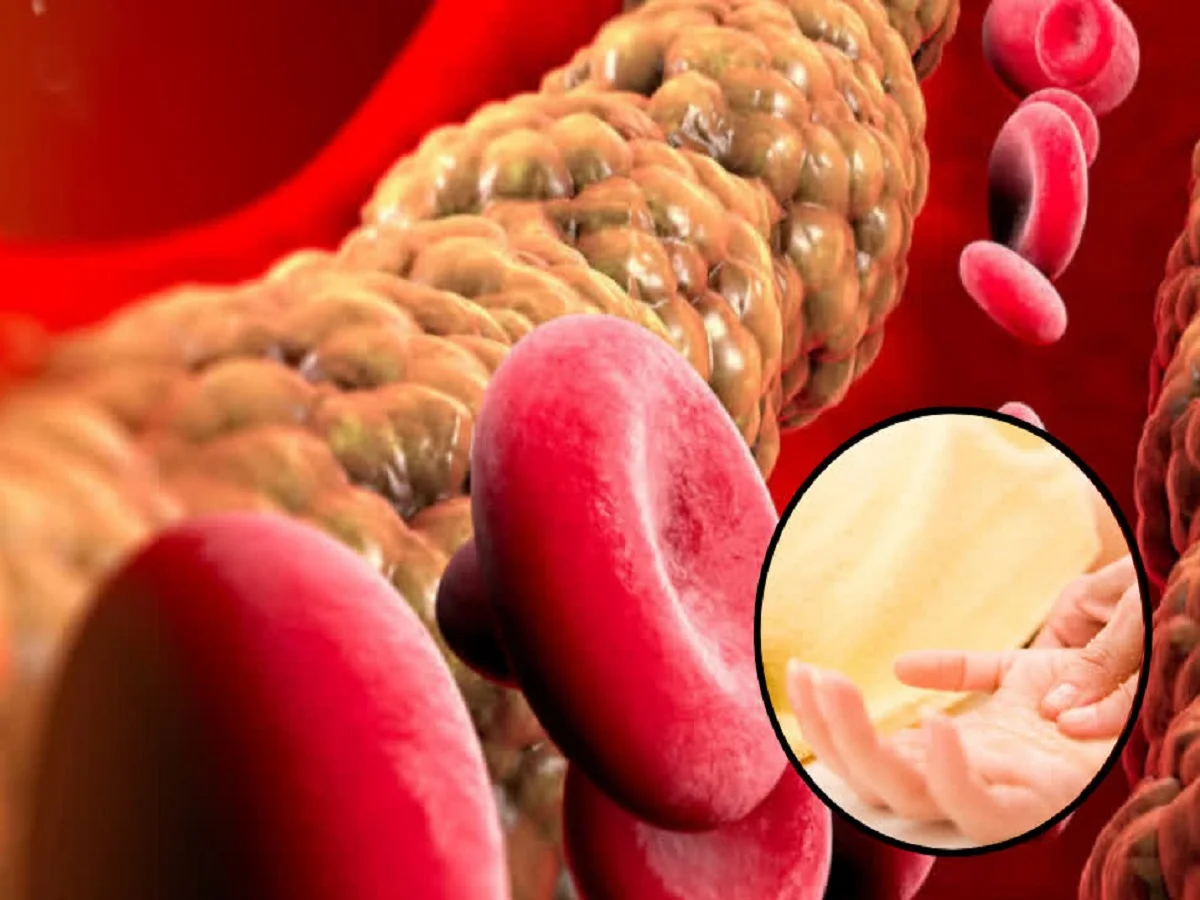 Health Tips: इन चीजों को डाइट में कर लें शामिल, मोम की तरह पिछल जाएगा नसों में जमा कोलेस्ट्रॉल