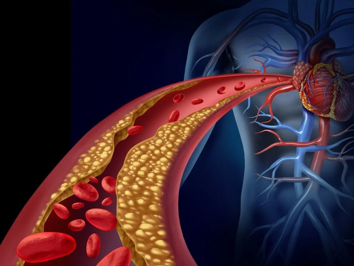 Health Tips: हाई कोलेस्ट्रॉल को कंट्रोल करने में उपयोगी हैं ये तीन फूड्स, डाइट में कर लें शामिल