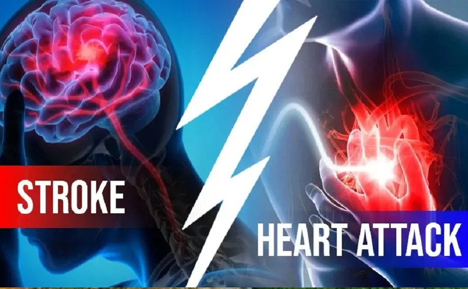 Health Tips: हार्ट अटैक और स्ट्रोक के ये हैं लक्षण, नहीं करें नजरअंदाज, पड़ सकता है भारी