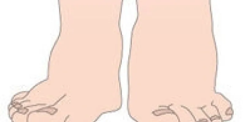 151svangerskabsforgift txt 75nm8t8pl