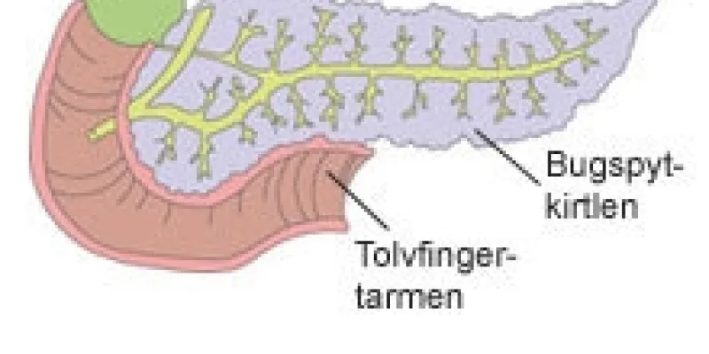 157 bugspytkitl txt 75nm8tf7b