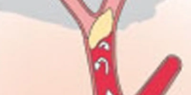 199 blodprop pulsaare 1 75nm8tfc5