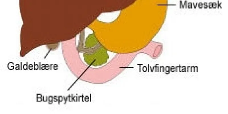 68 lever galdebl txt 75nm8tf77